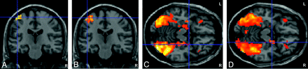 Fig 2.