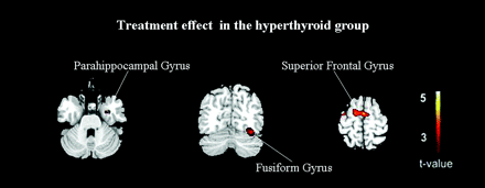 Fig 3.