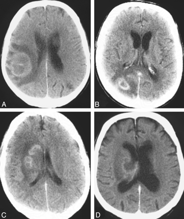 Fig 5.