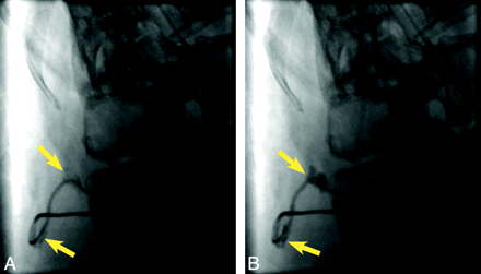 Fig 7.