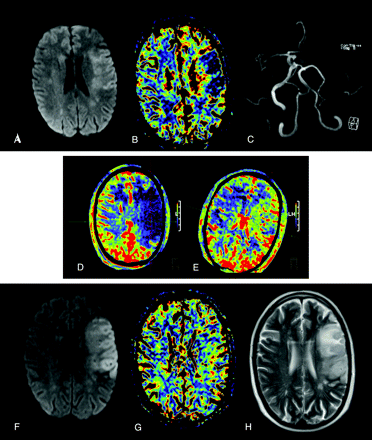 Fig 1.