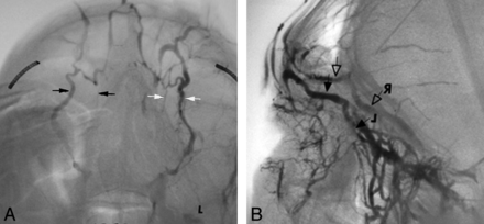 Fig 4.