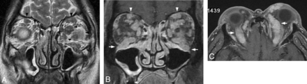 Fig 2.