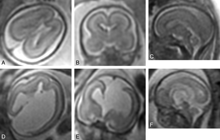 Fig 3.