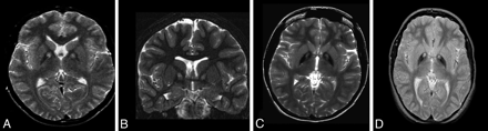 Fig 3.