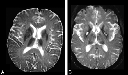 Fig 4.