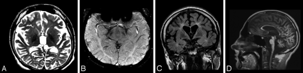 Fig 7.
