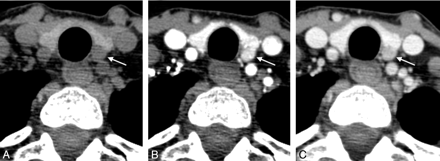 Fig 1.