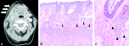 Fig 2.