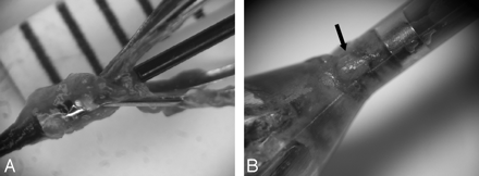 Fig 3.