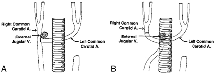 Fig 1.