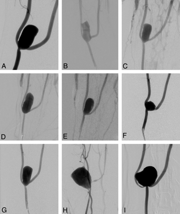 Fig 4.