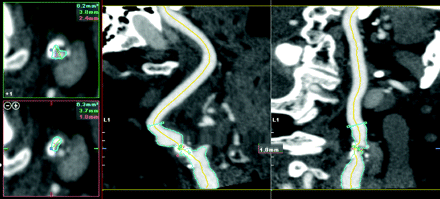 Fig 4.