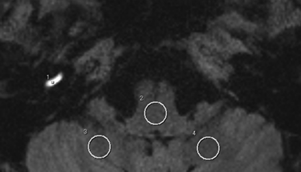 Fig 1.