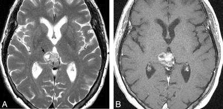 Fig 8.