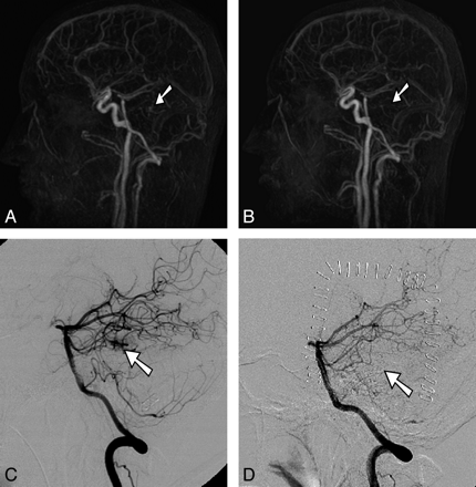 Fig 2.