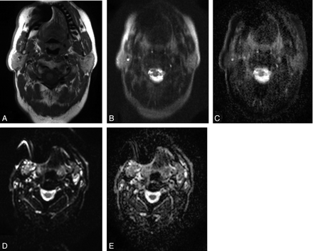 Fig 4.