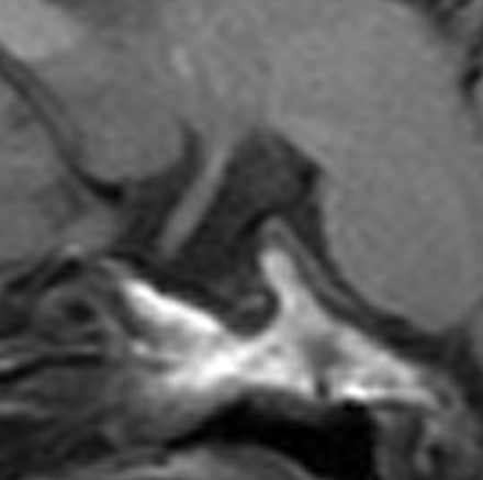 Fig 5.
