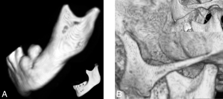 Fig 6.