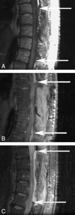 Fig 2.