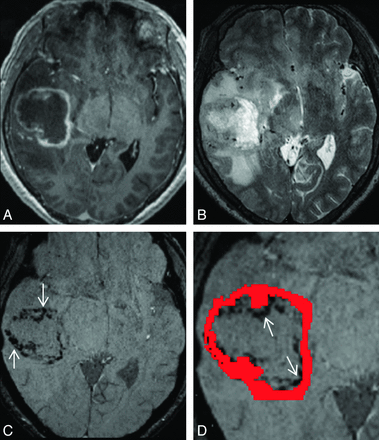 Fig 2.