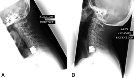 Fig 3.