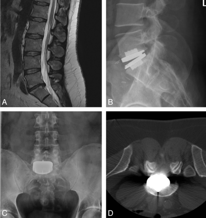 Fig 4.