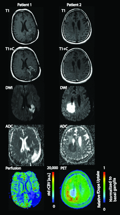 Fig 4.