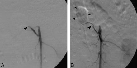 Fig 4.