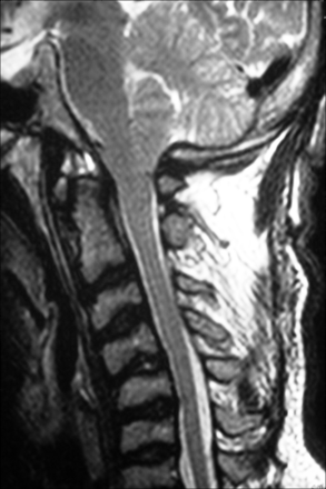 Fig 6.