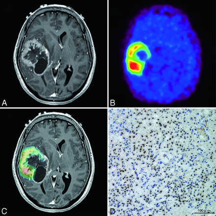 Fig 4.