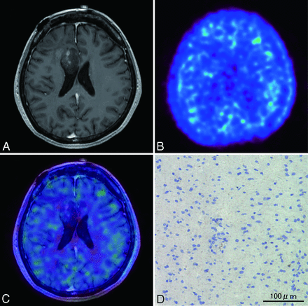 Fig 6.