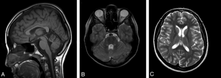 Fig 1.