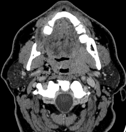 Fig 3.