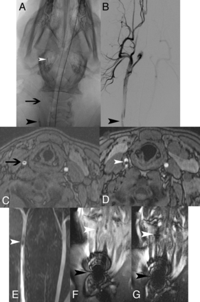 Fig 4.