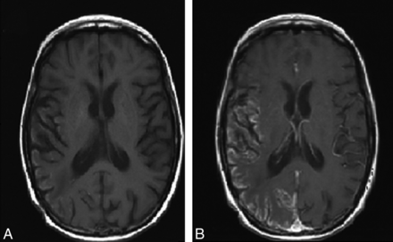 Fig 2.