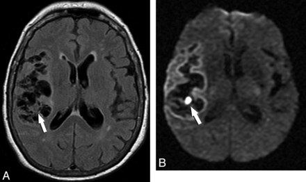 Fig 5.