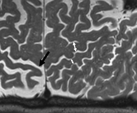 Fig 1.