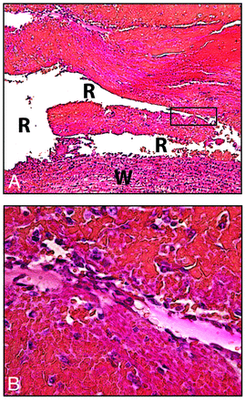 Fig 4.