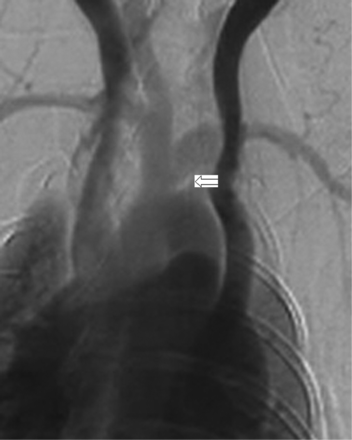 Fig 2.