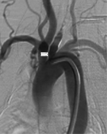 Fig 3.