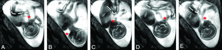 Fig 4.