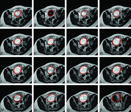 Fig 5.