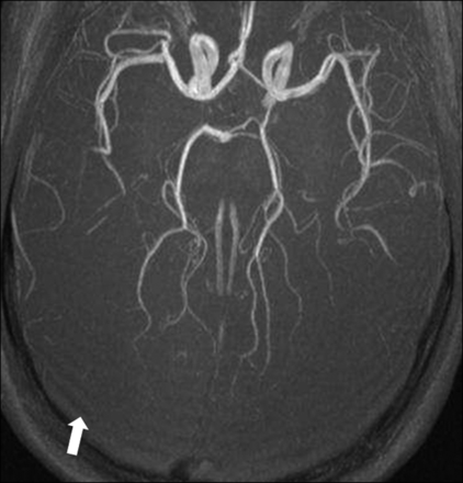 Fig 6.