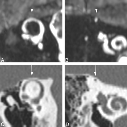 Fig 3.