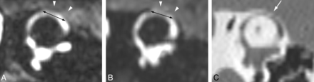 Fig 5.