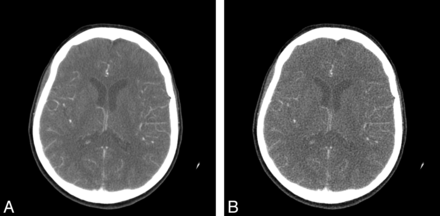 Fig 1.