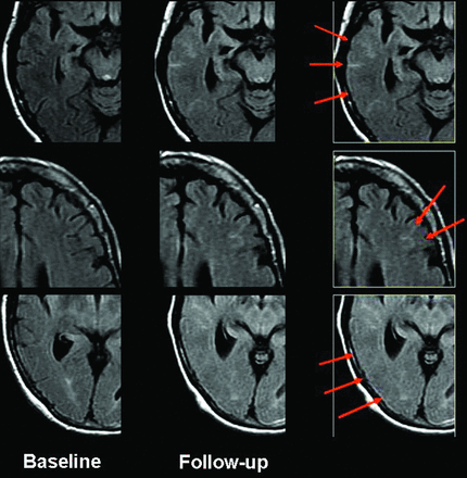 Fig 5.