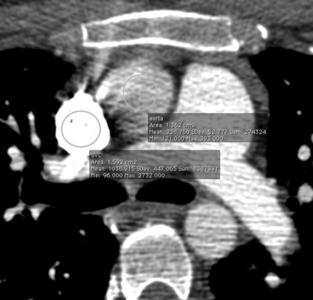 Fig 3.
