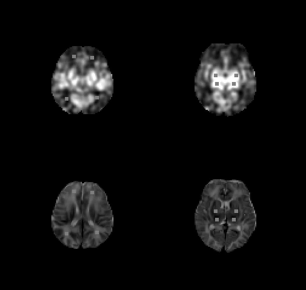 Fig 2.